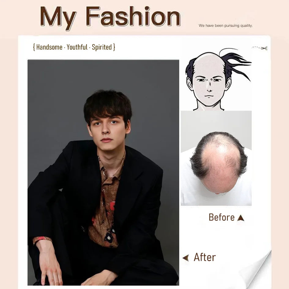 Synthetic wigs
